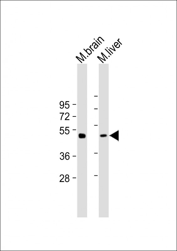 Rabbit Polyclonal Antibody to gamma Tubulin