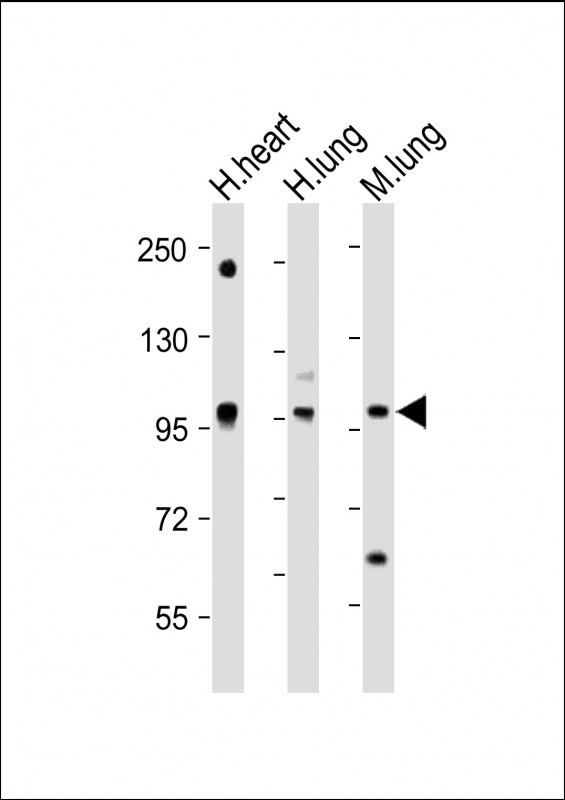 Rabbit Polyclonal Antibody to VSGP/F-spondin (N-term)