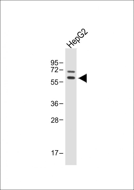 Rabbit Polyclonal Antibody to ASPG