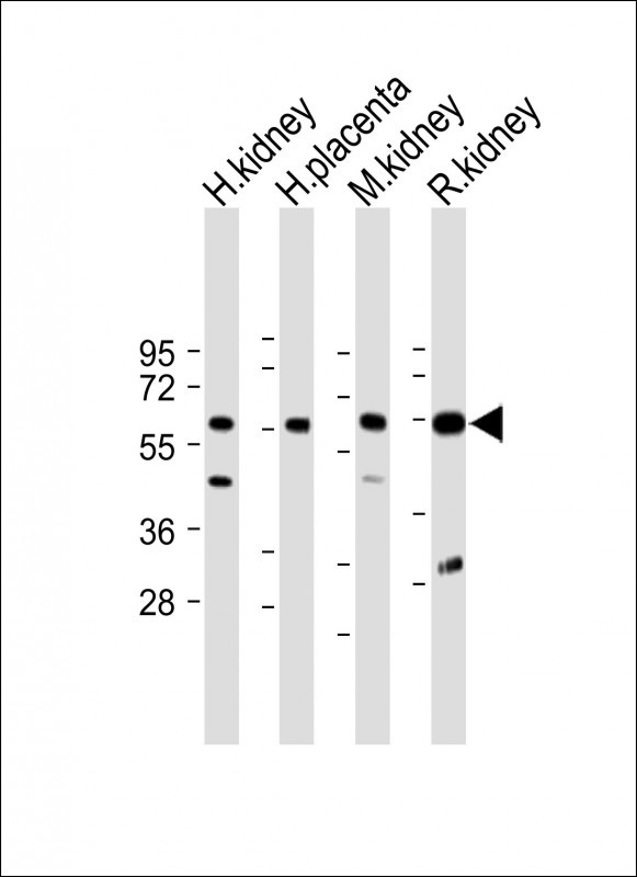 Rabbit Polyclonal Antibody to CRTR1 (N-term)