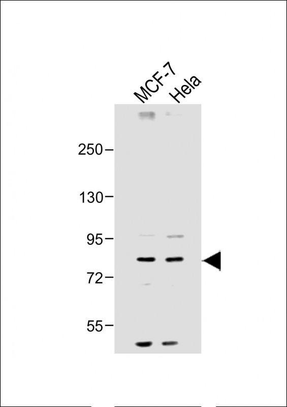 Rabbit Polyclonal Antibody to SMURF1 (N-term)