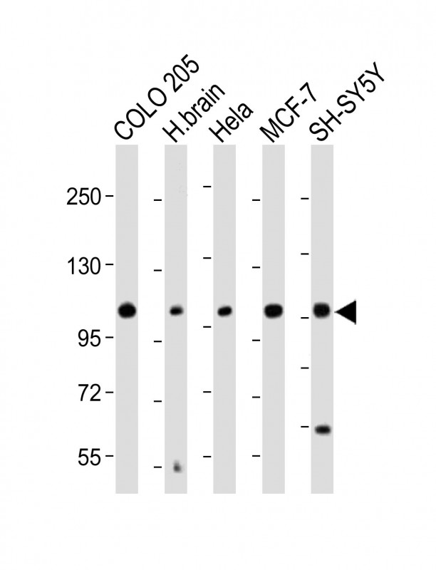 Rabbit Polyclonal Antibody to KCNH1