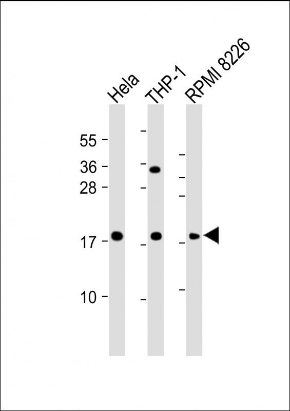 Rabbit Polyclonal Antibody to GPX7