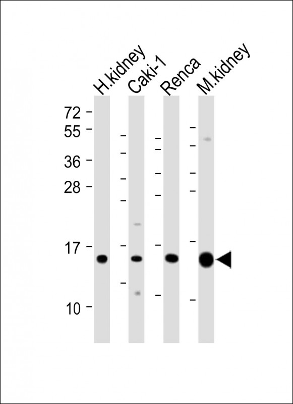Rabbit Polyclonal Antibody to ATP6V1G3 (N-Term)