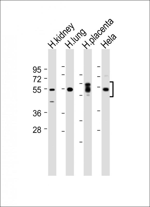 Rabbit Polyclonal Antibody to SGK (Ser78)