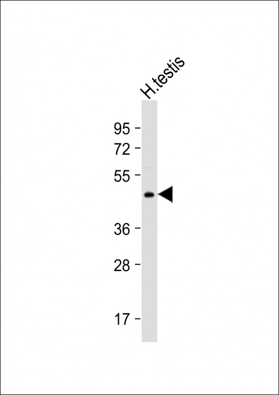 Rabbit Polyclonal Antibody to UBXN6  (C-term)