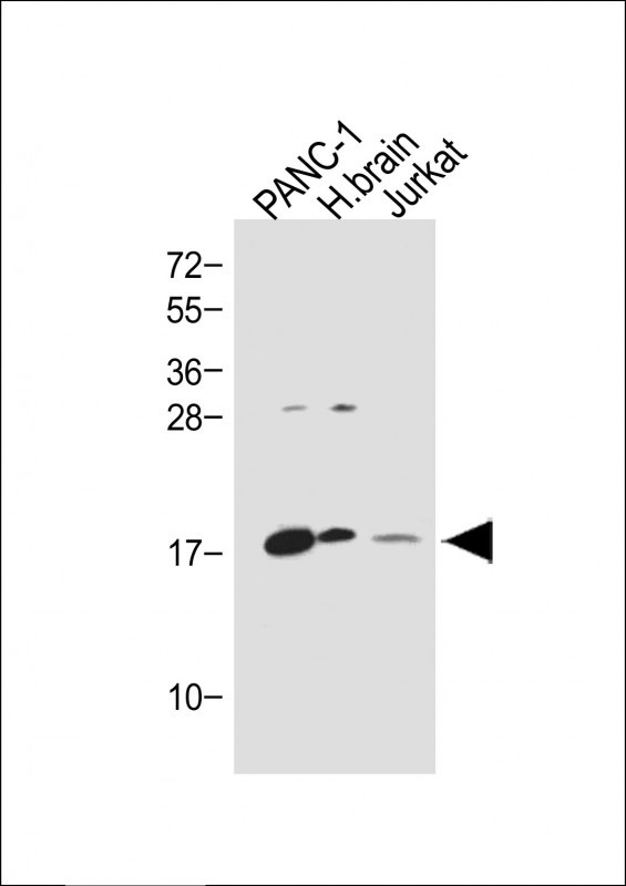 Rabbit Polyclonal Antibody to Glucagon