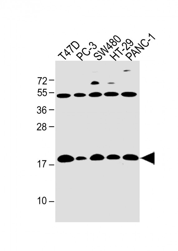 Rabbit Polyclonal Antibody to IFITM5
