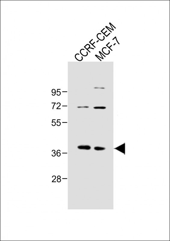 Rabbit Polyclonal Antibody to OGN