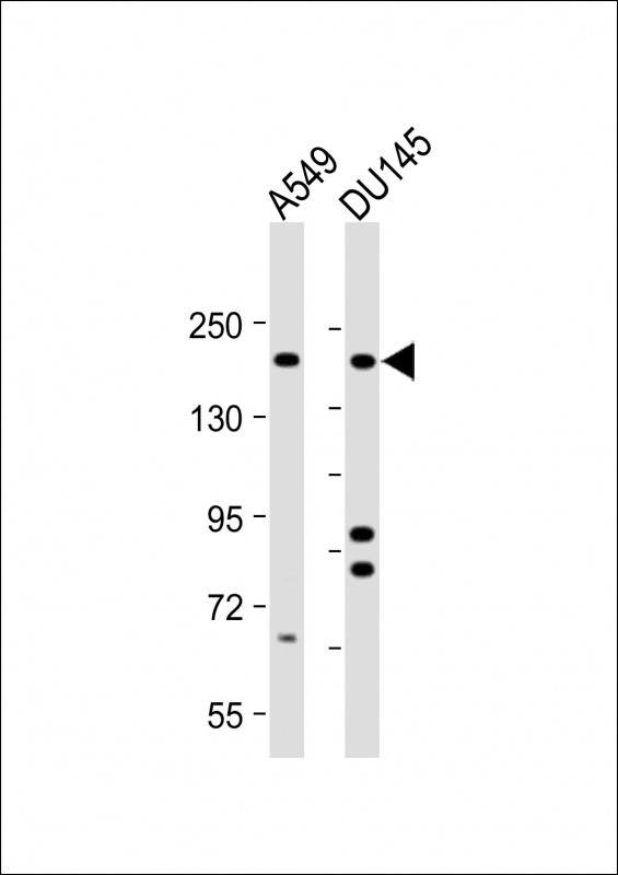 Rabbit Polyclonal Antibody to MED14