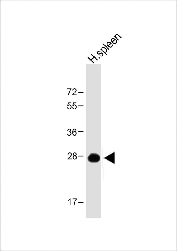 Rabbit Polyclonal Antibody to PRSSL1(C-term)