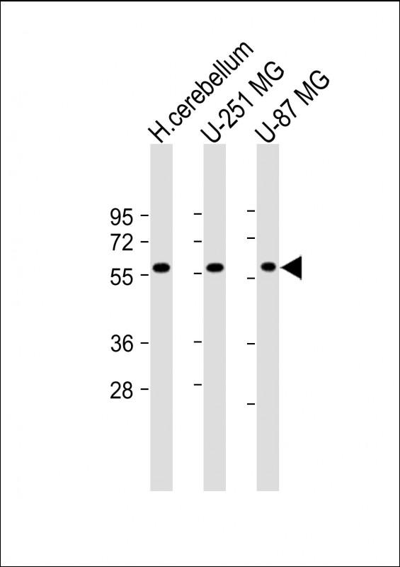 Rabbit Polyclonal Antibody to SHC2 (N-Term)