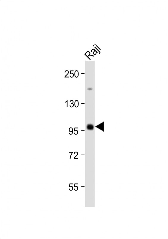 Rabbit Polyclonal Antibody to MAP4K1