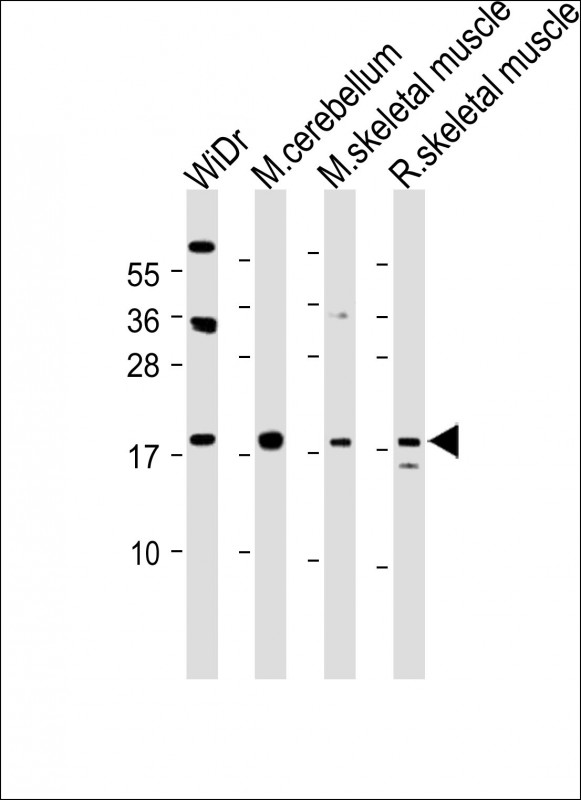Rabbit Polyclonal Antibody to TPPP3