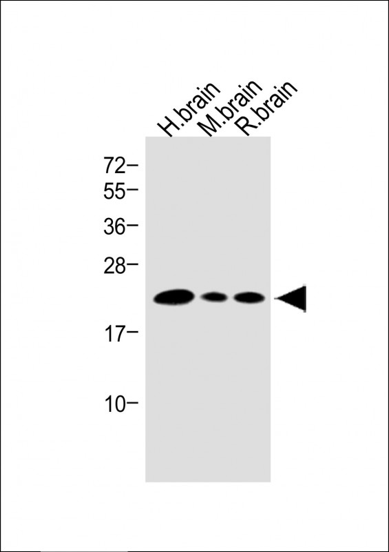 Rabbit Polyclonal Antibody to VILIP1