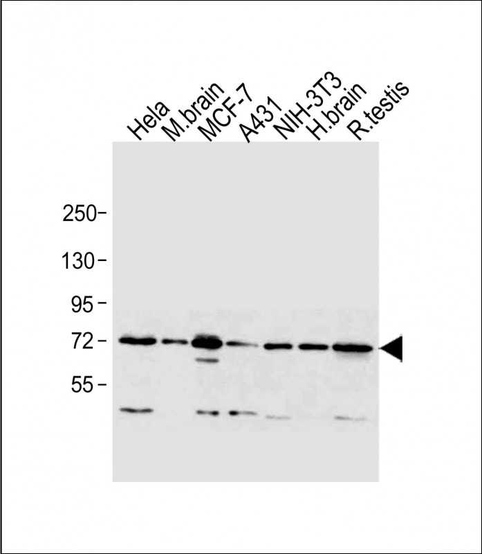 Rabbit Polyclonal Antibody to MTA1(C-term)