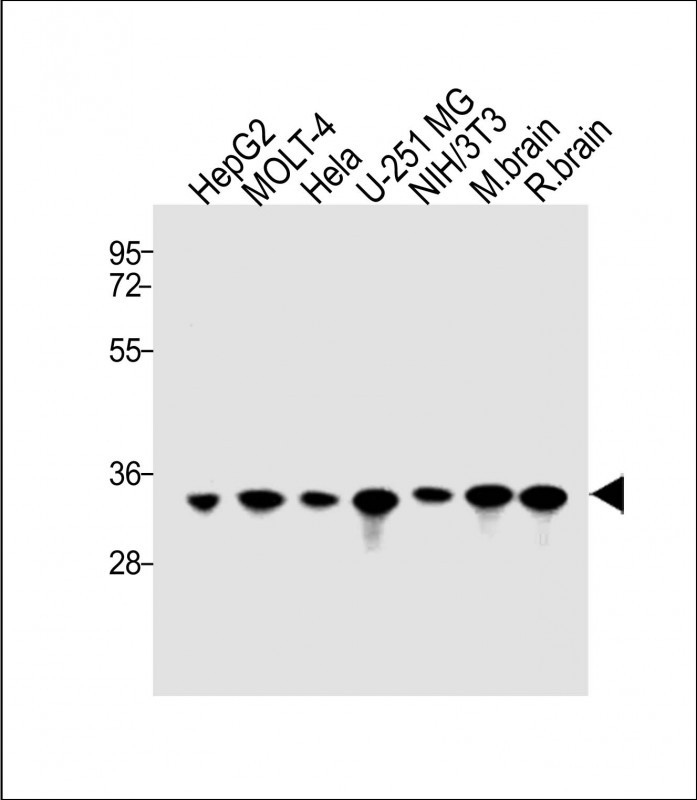 Rabbit Polyclonal Antibody to PITPNA