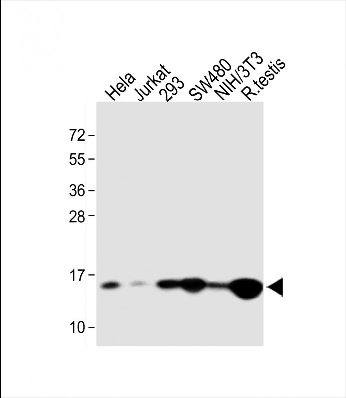 Rabbit Polyclonal Antibody to UBE2D2 (N-term)