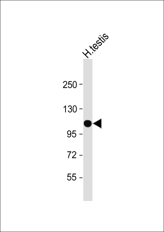 Rabbit Polyclonal Antibody to SLC14A2 (N-Term)