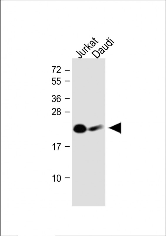 Rabbit Polyclonal Antibody to NCR3 (N-Term)