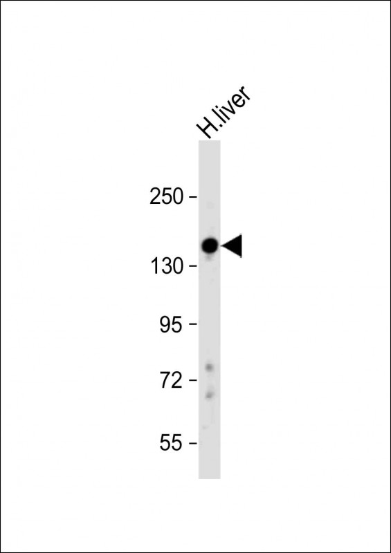 Rabbit Polyclonal Antibody to PRG4 (N-Term)