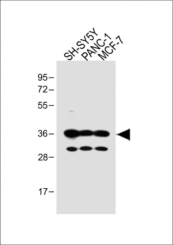 Rabbit Polyclonal Antibody to OR5V1