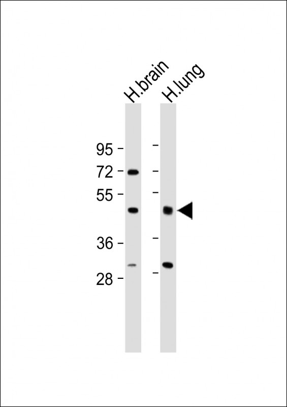 Rabbit Polyclonal Antibody to IFT57