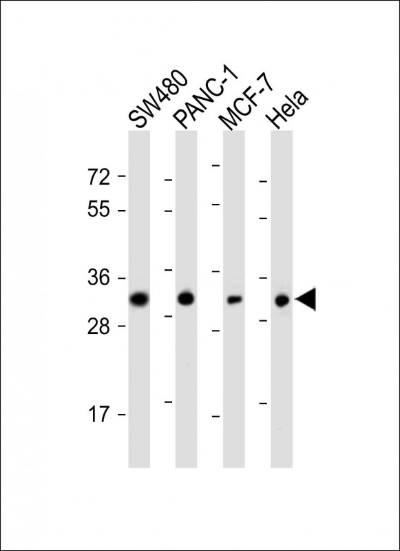 Rabbit Polyclonal Antibody to OR7C2