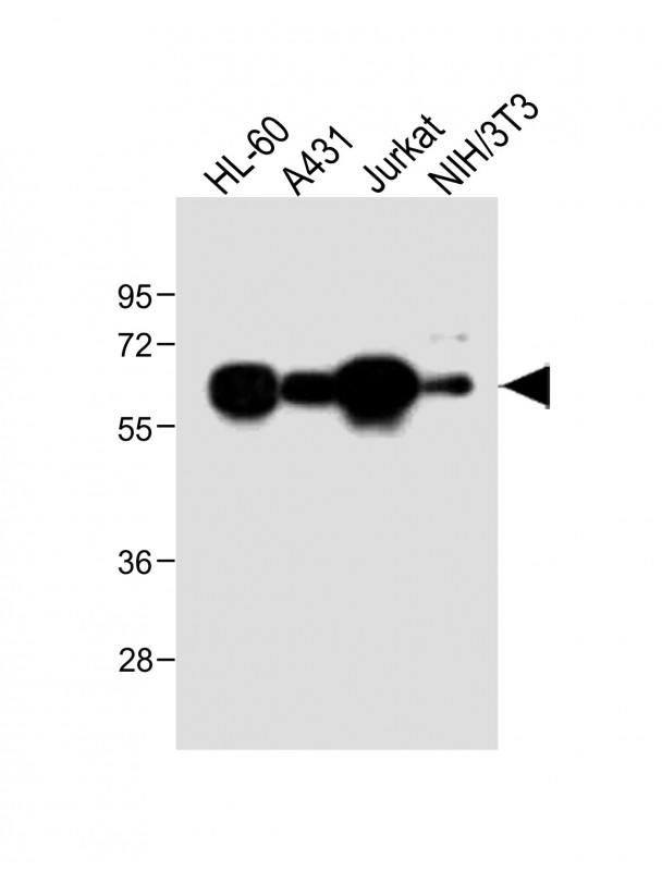 Rabbit Polyclonal Antibody to METTL14 (N-Term)