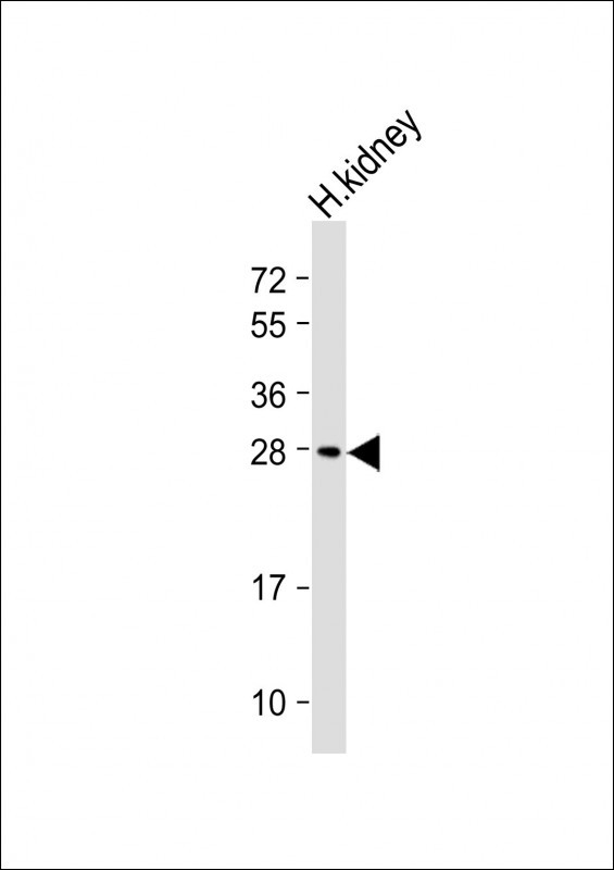 Rabbit Polyclonal Antibody to RNF4
