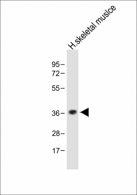 Rabbit Polyclonal Antibody to TAS2R5