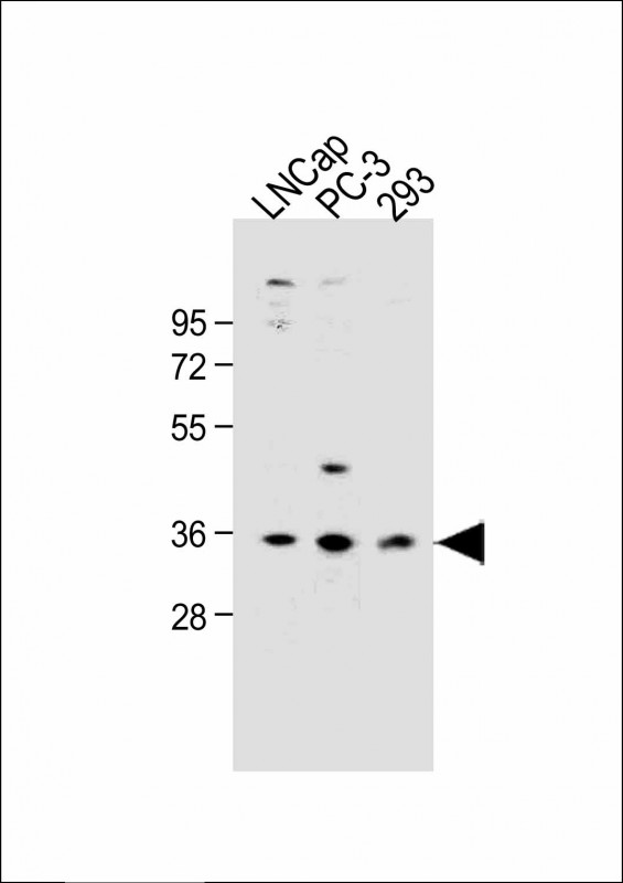 Rabbit Polyclonal Antibody to OR6C3