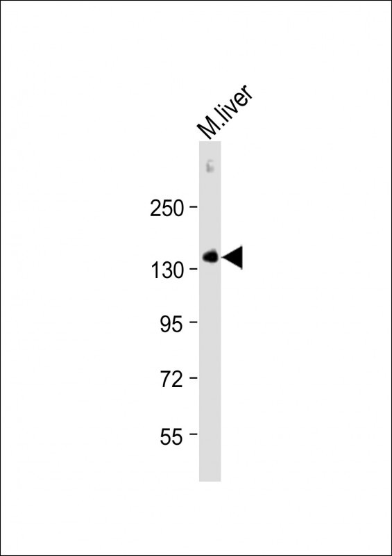 Rabbit Polyclonal Antibody to M CD31