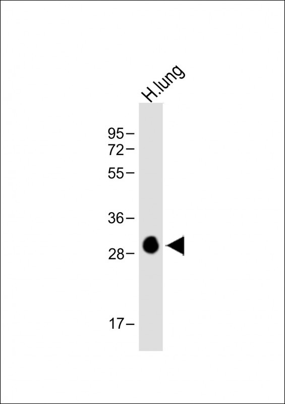 Rabbit Polyclonal Antibody to HLA-DPB1