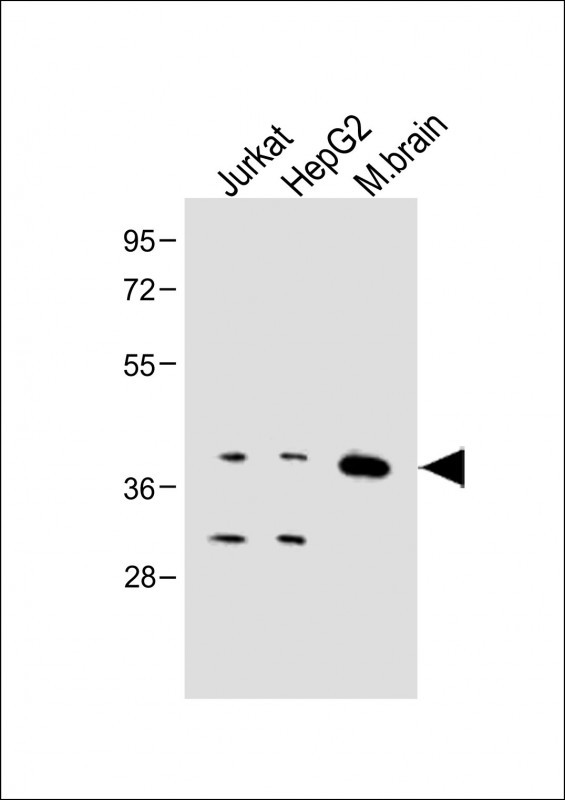 Rabbit Polyclonal Antibody to Connexin 40 (N-term)