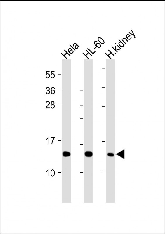 Rabbit Polyclonal Antibody to ND4L