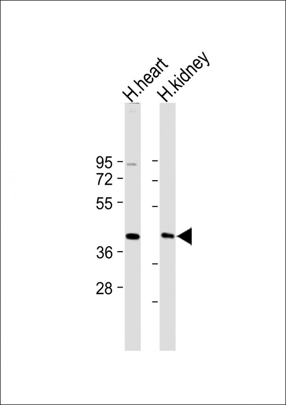 Rabbit Polyclonal Antibody to AADACL2
