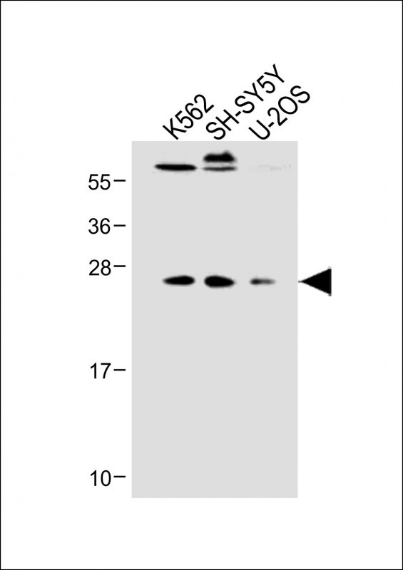 Rabbit Polyclonal Antibody to N6AMT1 (N-term)