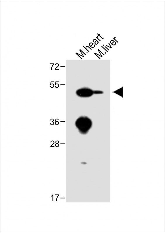 Rabbit Polyclonal Antibody to ENT1