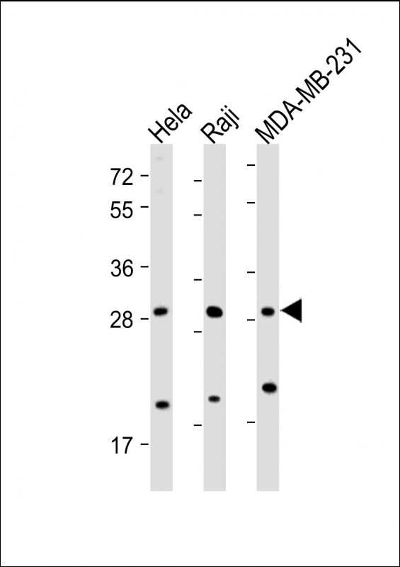 Rabbit Polyclonal Antibody to RAB12 (N-term)