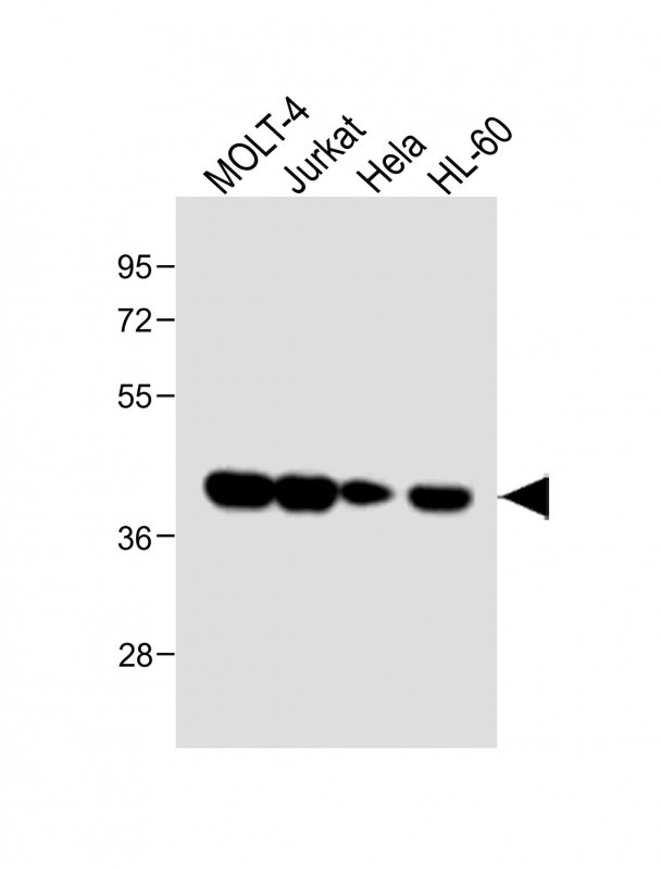 Rabbit Polyclonal Antibody to ADA