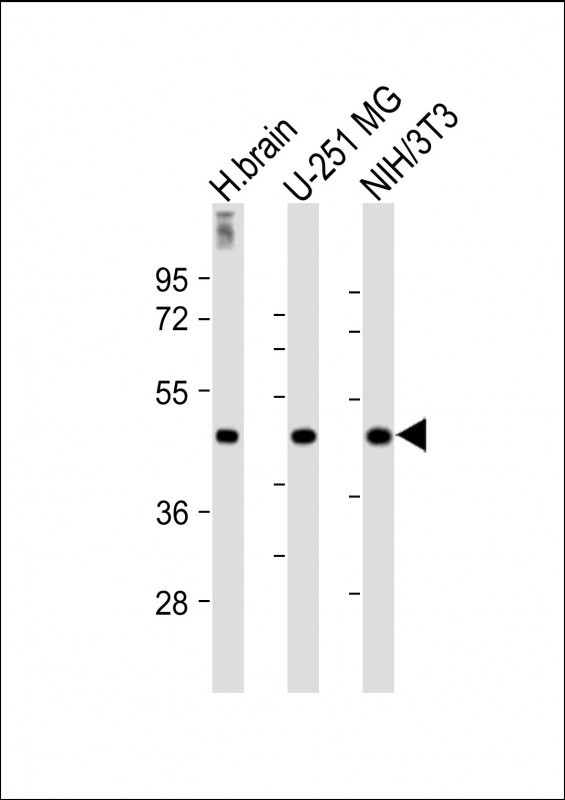 Rabbit Polyclonal Antibody to AP1M1