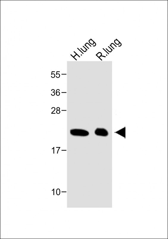 Rabbit Polyclonal Antibody to SFTPC (N-term)