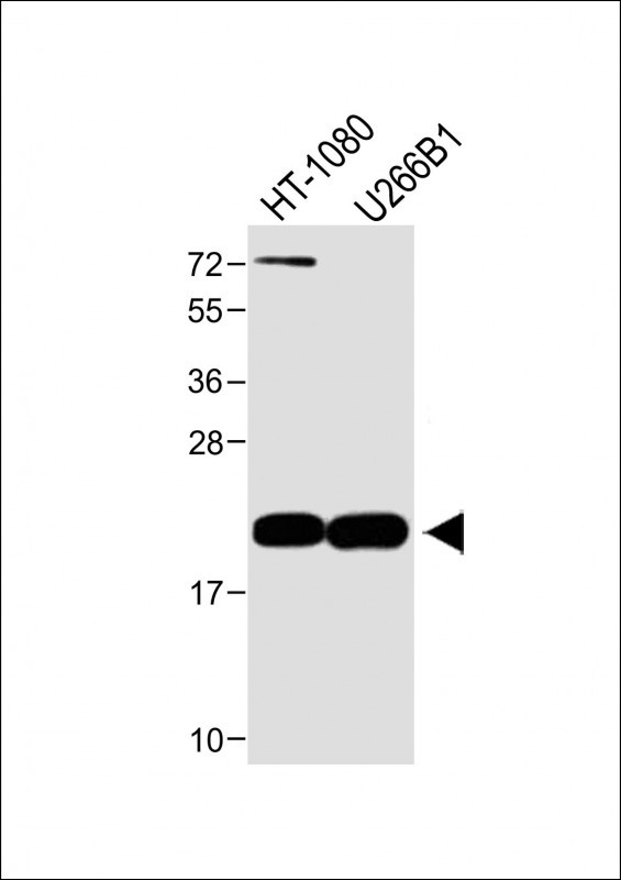 Rabbit Polyclonal Antibody to CTAG1A (N-term)