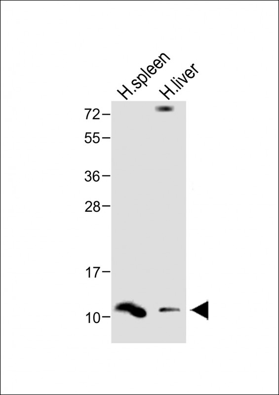 Rabbit Polyclonal Antibody to DEFA1