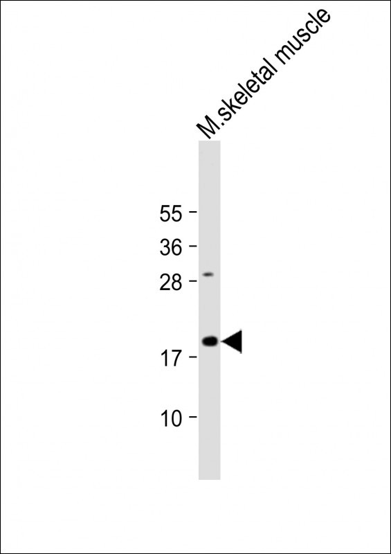 Rabbit Polyclonal Antibody to GREMLIN