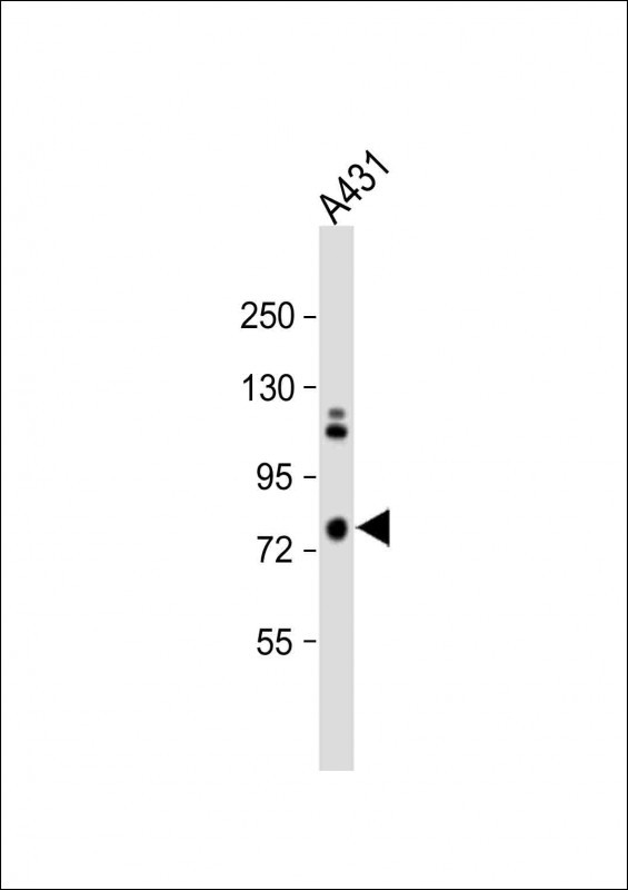 Rabbit Polyclonal Antibody to SCEL