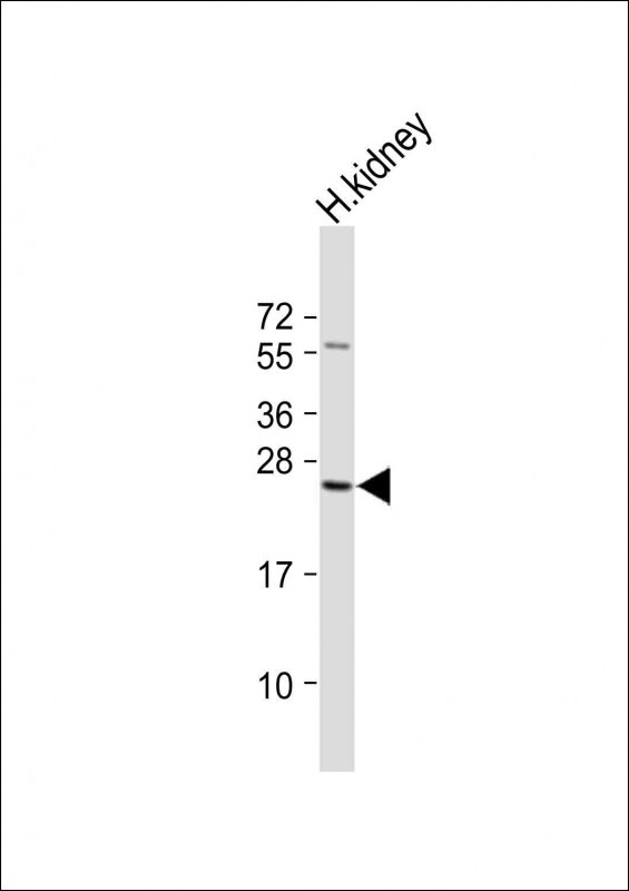 Rabbit Polyclonal Antibody to RAB28