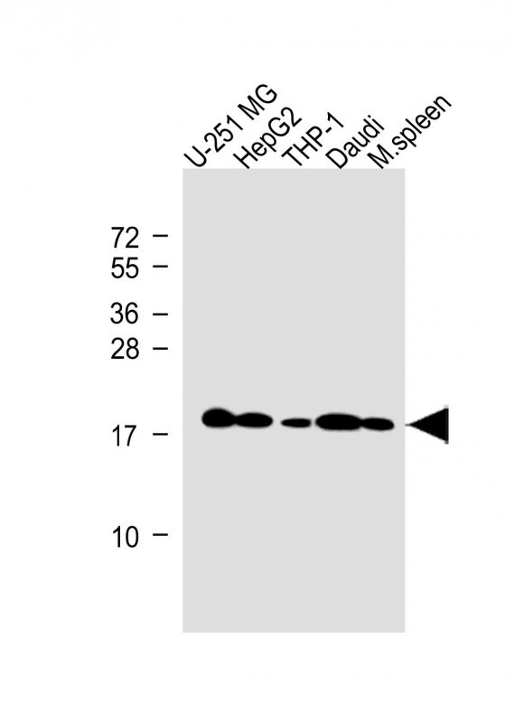 Rabbit Polyclonal Antibody to RS18