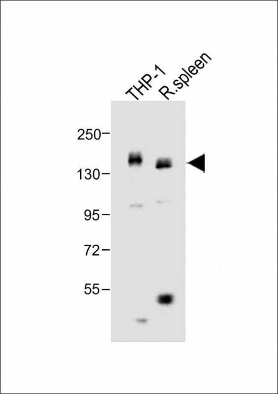 Rabbit Polyclonal Antibody to MCSF Receptor (CSF1R)